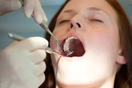 Woman having her teeth cleaned Woman having her teeth cleaned